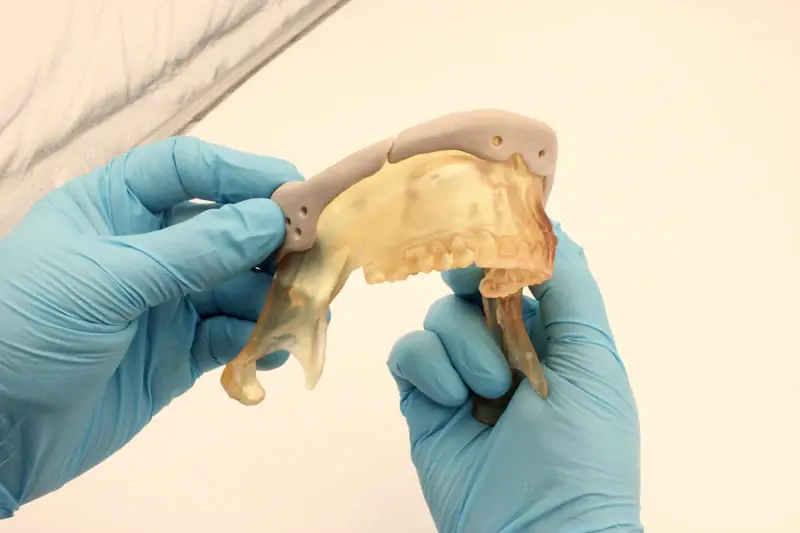 Gloved hands holding a partial denture frame